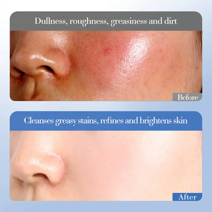 Conjunto de Cuidados Essenciais com a pele Use Nuvé, soro facial clareador, creme removedor de rugas, encolhe os poros, desbota, melanina opaca, hidrata e ilumina, (6 peças)